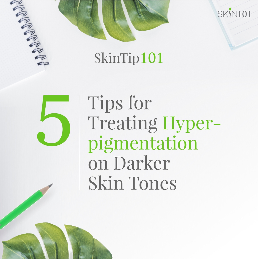 5 Tips For Treating Hyperpigmentation On Darker Skin